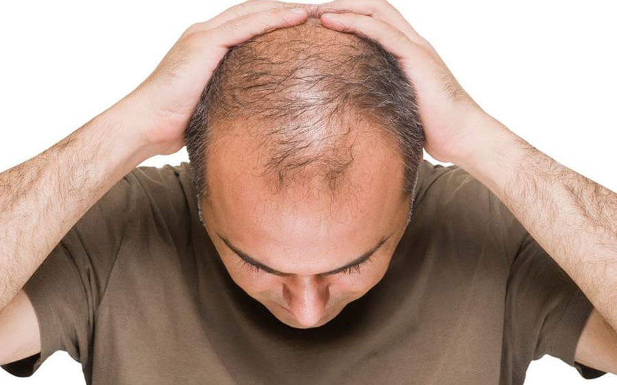 red light therapy for hair loss