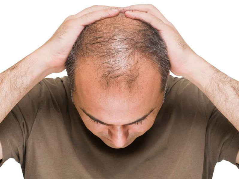 red light therapy for hair loss