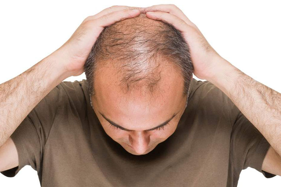 red light therapy for hair loss